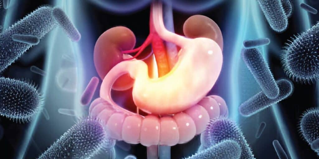 Grippe intestinale